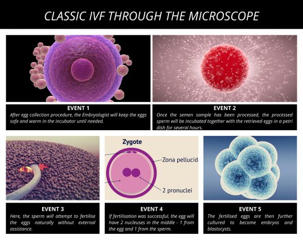 Classic-IVF-Through-The-Microscope