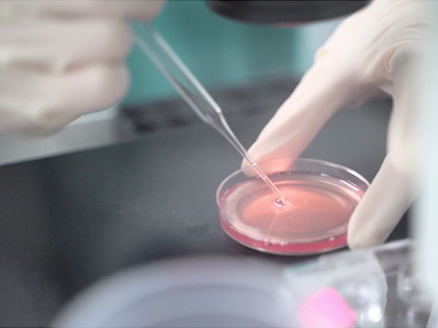 Types of Treatment for Infertility