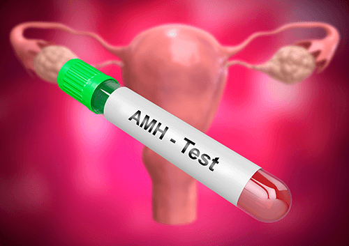 AMH Test