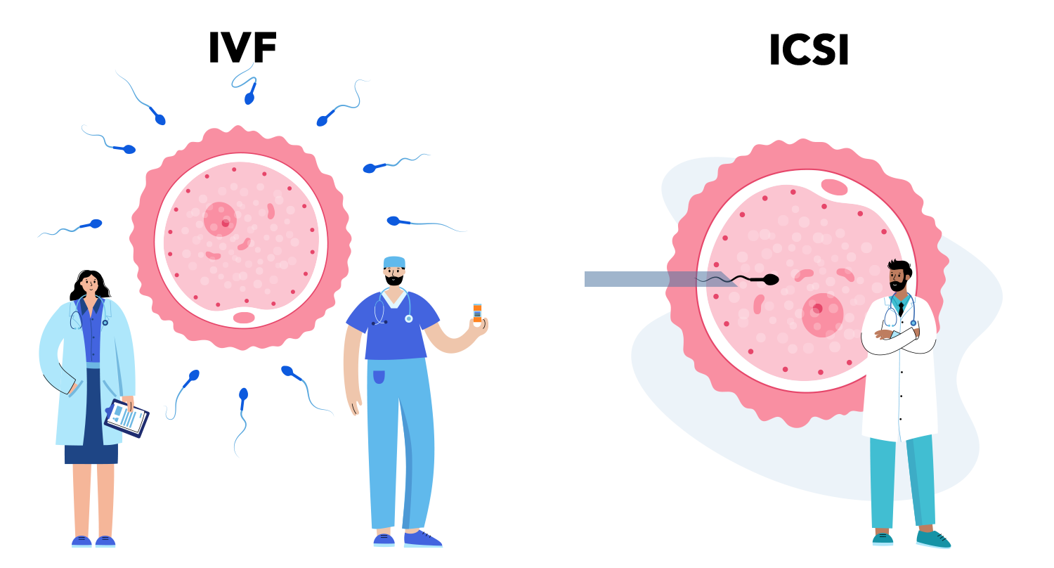 IVF and ICSI - What's the Difference?