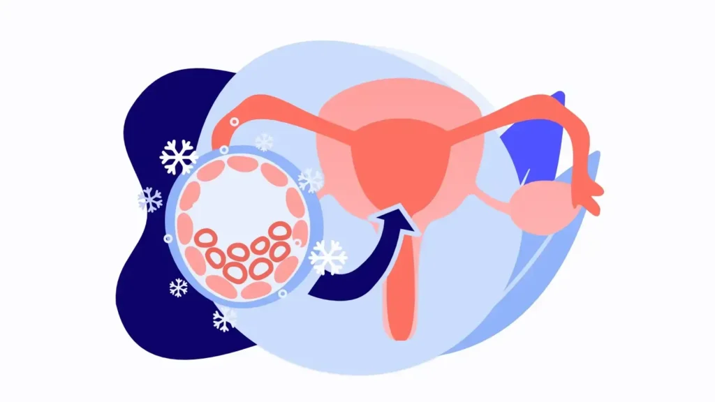 Frozen Embryo Transsfer