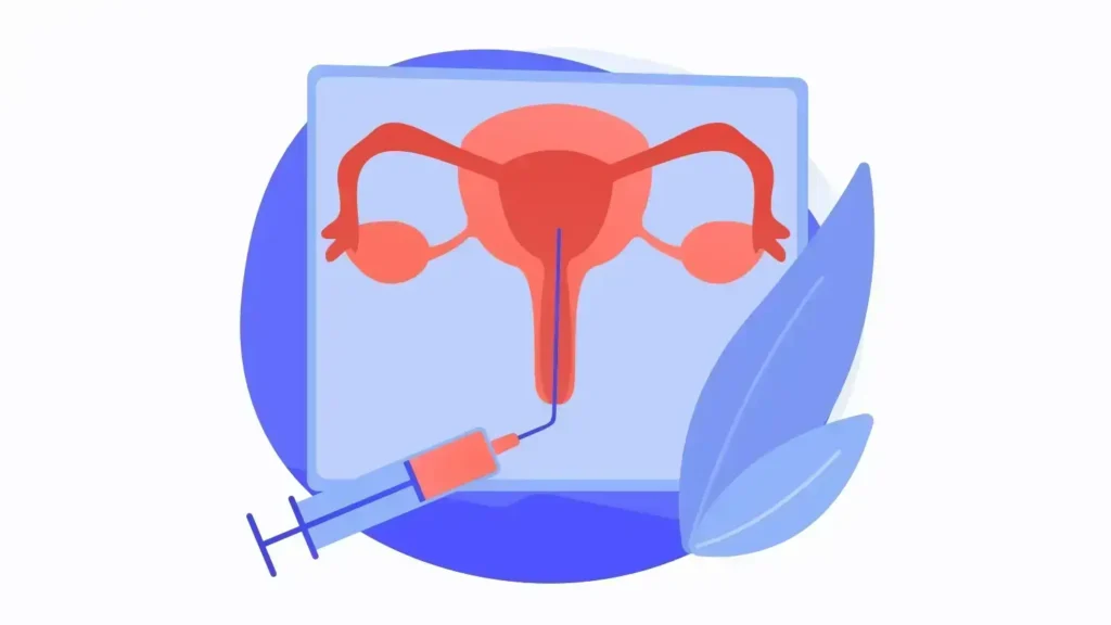 IUI