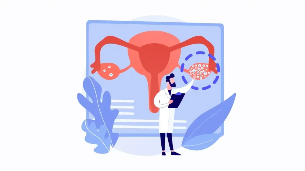 PCOS