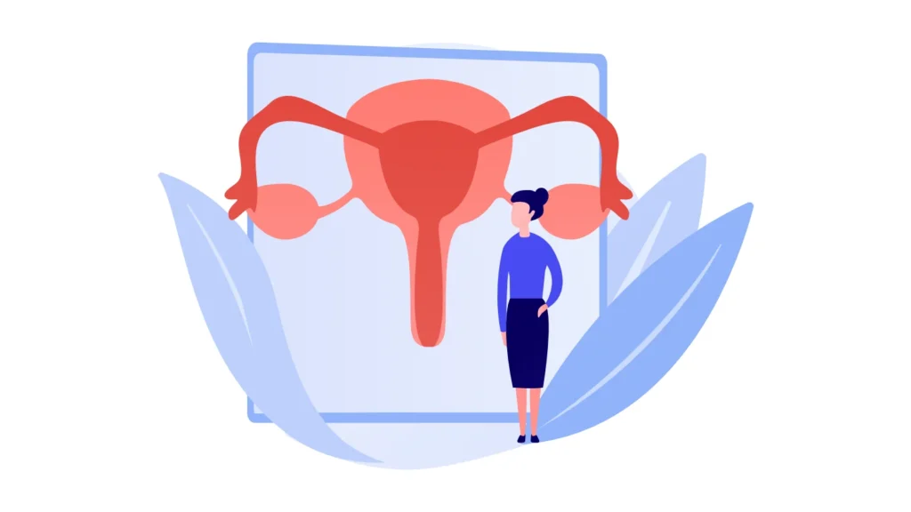 Illustration for Uterine Abnormalities